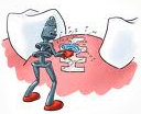 Teeth in an hour-BOI, Teeth in an Hour dental clinic in delhi
