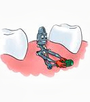 Teeth in an Hour dental clinic in delhi