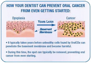 Early Oral Cancer detection using Brush Biopsy or Oral CDX