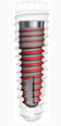 Uniti Implant