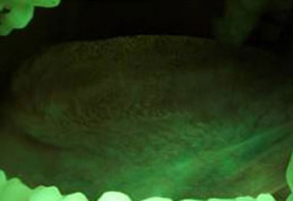 Velscope